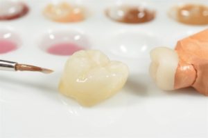 Types of Dental Crowns