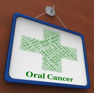 Oral Cancer Board