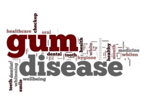 Gum Disease