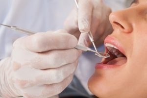 Dentist Examining woman's Teeth