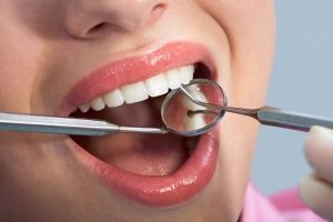 Dentist Examining woman's Teeth