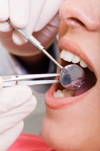 Dentist Examining woman's Teeth