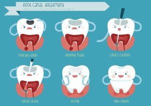 Symptoms of Gum Disease